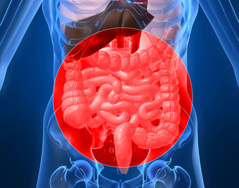 Magen-Darm-Erkrankungen-Reizdarm